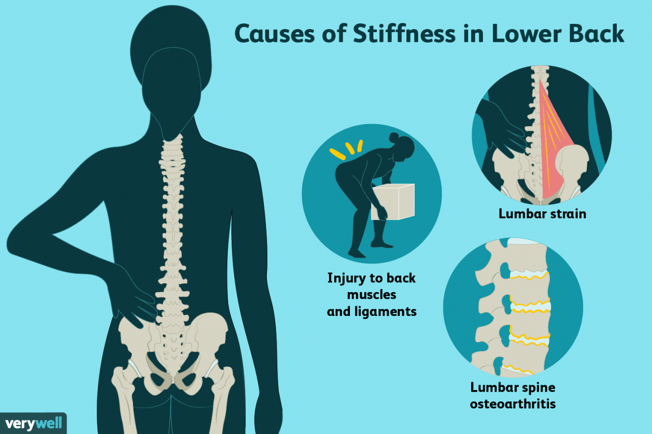 How can stiff and tight muscles result in back pain?