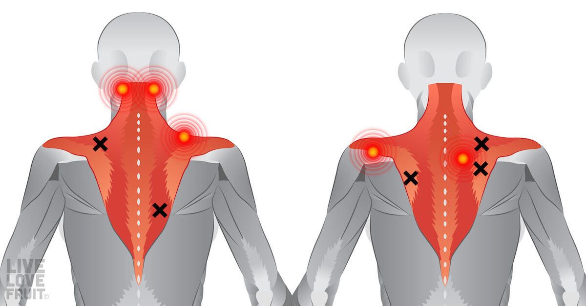 Muscle neck pain shoulder rhomboid back upper blades between causes symptoms stretches relief region muscles just blade spasm treatment exercises